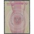 Argentina 2493 2004 Lucha contra el cáncer de colon y de útero MNH